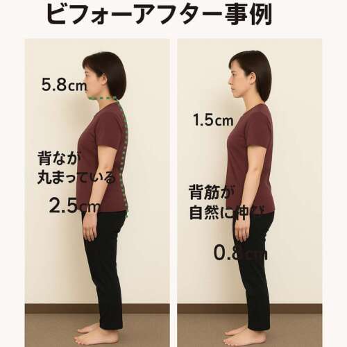 整体用・姿勢チェックビフォーアフター木製枠 AI姿勢分析で“若返り”40代女性の驚きのビフォーアフター事例」 | 市川