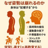 姿勢が崩れる原因を示すイラスト。赤い猫背姿勢、緑の正しい姿勢、脳の記憶イメージ、長時間の座位・運動量低下・片側偏重・呼吸の浅さなど、身体が“姿勢を記憶する”仕組みを表現している。
