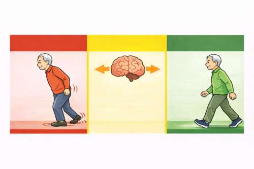 赤・黄・緑の3分割イラスト。左は前かがみで腰から動く不安定な歩行、中央は脳のイメージ、右は姿勢が整い足が上がる安定した歩行を示している。