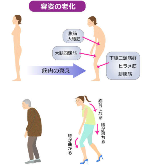 老化により姿勢が崩れ、筋肉の衰えで猫背・膝曲がり・腰の落ち込みが進む様子を示した図。腹筋、大腿四頭筋、下腿三頭筋などの弱化が原因として示されている。
