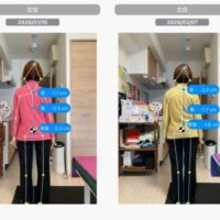 「86歳女性のO脚改善ビフォーアフター画像。背面からのAI姿勢分析で、首・胸・骨盤の左右差と重心の変化が表示されており、膝のねじれや足の歪みが改善している様子が確認できる。」