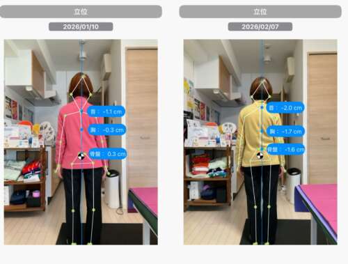 「86歳女性のO脚改善ビフォーアフター画像。背面からのAI姿勢分析で、首・胸・骨盤の左右差と重心の変化が表示されており、膝のねじれや足の歪みが改善している様子が確認できる。」