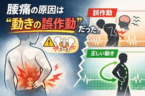 「腰痛の原因は“動きの誤作動”だった」と書かれた画像で、左側に腰を押さえる人の後ろ姿、右側に誤作動の動きと正しい動きのシルエットが対比して描かれている。