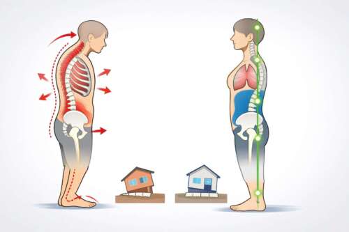 「猫背の崩れた姿勢と、構造が整った正しい姿勢を比較した図。左は背骨や肋骨が前屈し筋バランスが乱れ、右は骨盤・背骨・胸郭が一直線に整い、自然に良い姿勢が保たれている。」