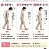 【予防】老ける人の共通動作3選を解説した画像。猫背歩き・小さな歩幅・腕を振らない歩き方が、老化や転倒リスクにつながることを紹介している。